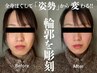 3月【土台から整える本格小顔】強圧ほぐし×整体×リンパ120分小顔矯正20分