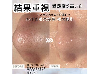 レーヴ アヴニール(Reve Avenir)の写真