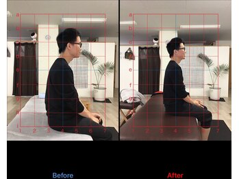 ストレチックス 近江八幡店/BeforeAfter