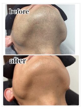 エアリアル 八代店/アゴ髭