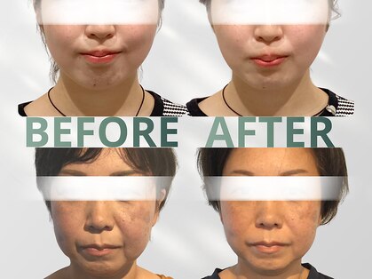 ハリット(haritt)の写真