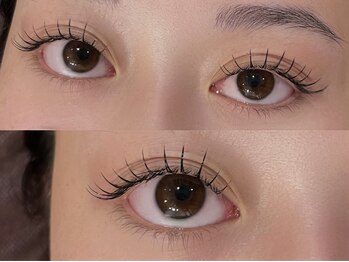 ネストアイ(NEST eye)/Extension