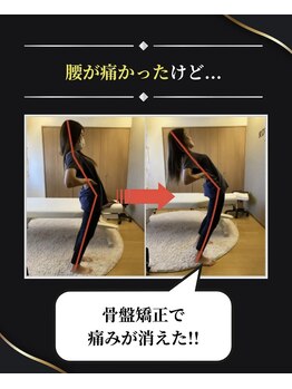 整体 寿 立川院(KOTOBUKI)/腰が痛かったけど・・・！