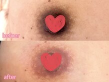 カシェット(cachette)/ローマピンク・ニップル