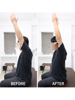 ジェイミープラス 表参道(J‘aimee +)/肩甲骨ビフォーアフター