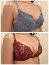 美人バスト 新宿店/☆姉妹店バストアップ症例写真☆