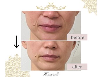 コモレビ(Komorebi)/