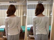 心鍼灸マッサージ整骨院/側湾、姿勢、骨盤矯正、整体