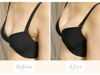 ノルン(Norn)/30代バストケア