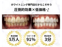 LBSホワイトニング 上野店