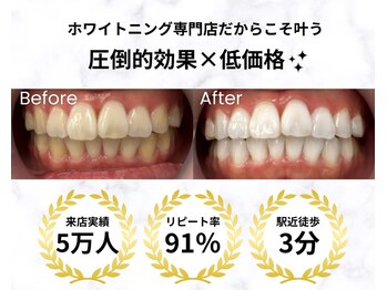 LBSホワイトニング 上野店