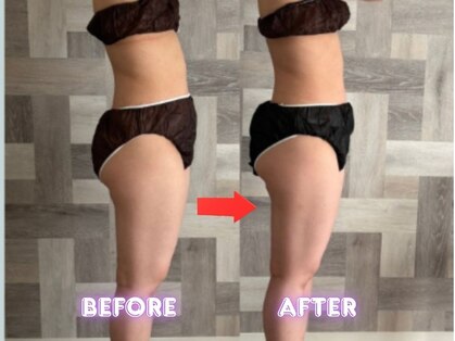 ヨサパークカインド(YOSA PARK Kind)の写真