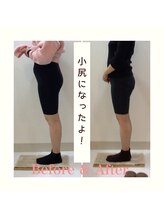 スタイルラボ高松/産後の骨盤矯正の効果♪