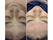 ラニア(Lania)の雰囲気（ニキビ予防、毛穴、シミケア全てのお悩みをシリカで改善します◎）