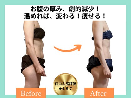 ヨサパーク ナンシー(YOSA PARK Nancy)の写真