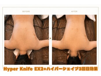 ドクタースタイル(Dr.style)/後ろ姿の印象はラインで変わる