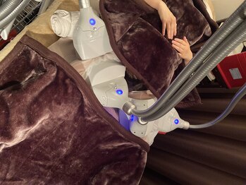 ブルースター(Blue Star)/脂肪冷却4カップ施術風景