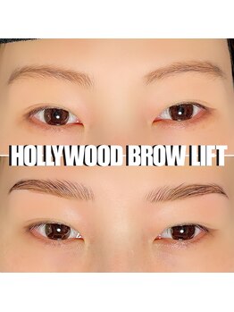 ヴィータ(VITA)/ハリウッドブロウリフト