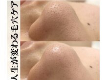 ブレア(Blair)/毛穴のお掃除