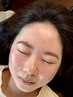 《透明感UP!》美眉スタイリング+2パーツWAX(小鼻とリップ周り)