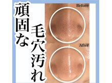 リノ沼津(Lino)の雰囲気（シミやくすみや毛穴などご自身のお悩改善のオーダーメイド施術）