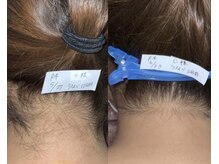 プリマ 栄店(Prima)/BEFORE&AFTER