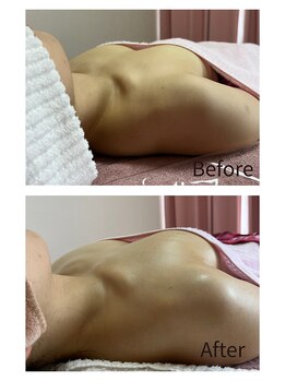 チュラ 大宮店(Chura)/【30代】1回の施術でここまで!?