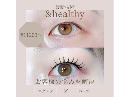 ヴィネル(Vinel)の写真