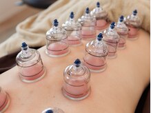 オリーブ鍼灸院/カッピング