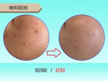 癒し工房ゆらぎ(YURAGI)/BEFORE/AFTER