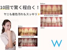 ホワイトニングショップ 大阪玉造店の雰囲気（簡単スピーディーなセルフホワイトニングホワイトニング専門店）