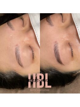 ノルジャ(NOLZA)/【HBL】ハリウッドブロウリフト