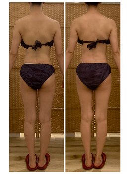 フラウラ(Fraula)/むくみもスッキリ！