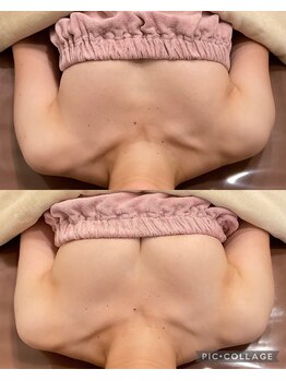 アネラ 京都駅前店(Anela)/【ボリュームUP！！】