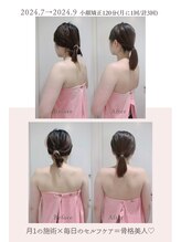 トゥインクル 麻布(twinkle)/南麻布/シンメトリー小顔矯正