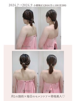 トゥインクル 麻布(twinkle)/南麻布/シンメトリー小顔矯正