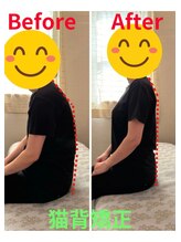 アクア(AQUA)/猫背姿勢矯正