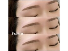 ポラリス(Polaris)の雰囲気（角質も取ってスッキリ！垢抜け顔に♪）