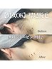 【脱毛/男女OK】襟足脱毛(うなじ脱毛)シェービング付