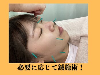 神田ふれあい鍼灸整骨院/必要に応じて鍼施術