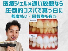 スマイルホワイト 練馬店