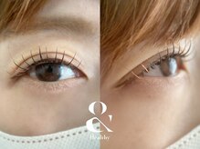 ムニ(muni)/&healthy【アンドヘルシー】