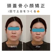 スイスパ(SUII SPA)