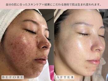 レディラック 大阪梅田本店(Lady Luck)