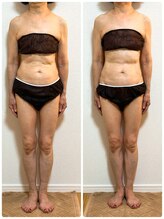 ソレイユ 北千住店(soleil)/気にしてらした下腹部の変化（1)