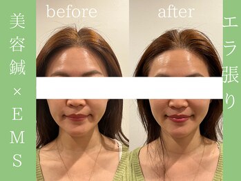 ビープラス(BEE PLUS)/エラ張り