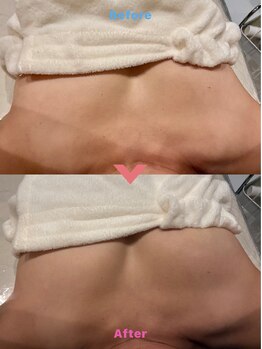 ブエナイン(Buenaine)の写真/リンパを流してバストUP促進！横に流れたバストの脂肪を戻す・姿勢改善で位置UP・ 巡り改善でふっくら