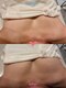 ブエナイン(Buenaine)の写真/リンパを流してバストUP促進！横に流れたバストの脂肪を戻す・姿勢改善で位置UP・ 巡り改善でふっくら