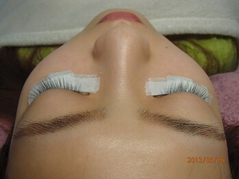 グラマー(Glamour)/施術前