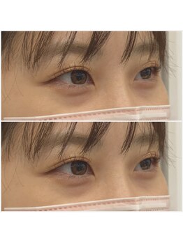 ミント アイラッシュ(mint)/アップワードリフト